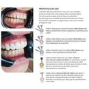 Kit Ultra-Gloss Polimento de Resina - American Burrs